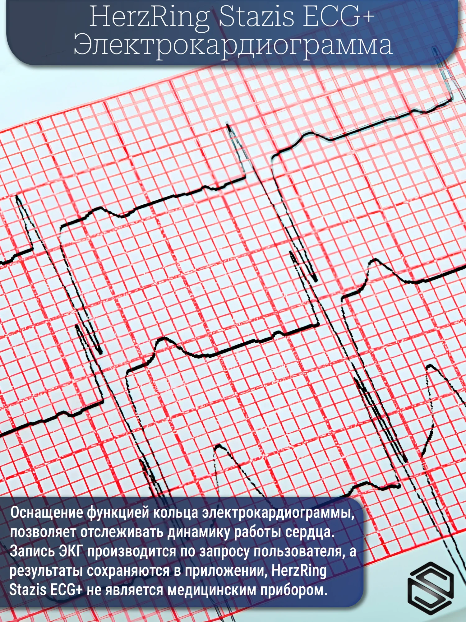Ecg